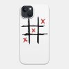 Louis Tomlinson Xxx Phone Case Official Louis Tomlinson Merch